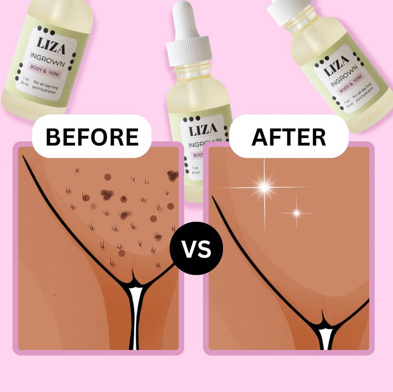 Ingrown Oil